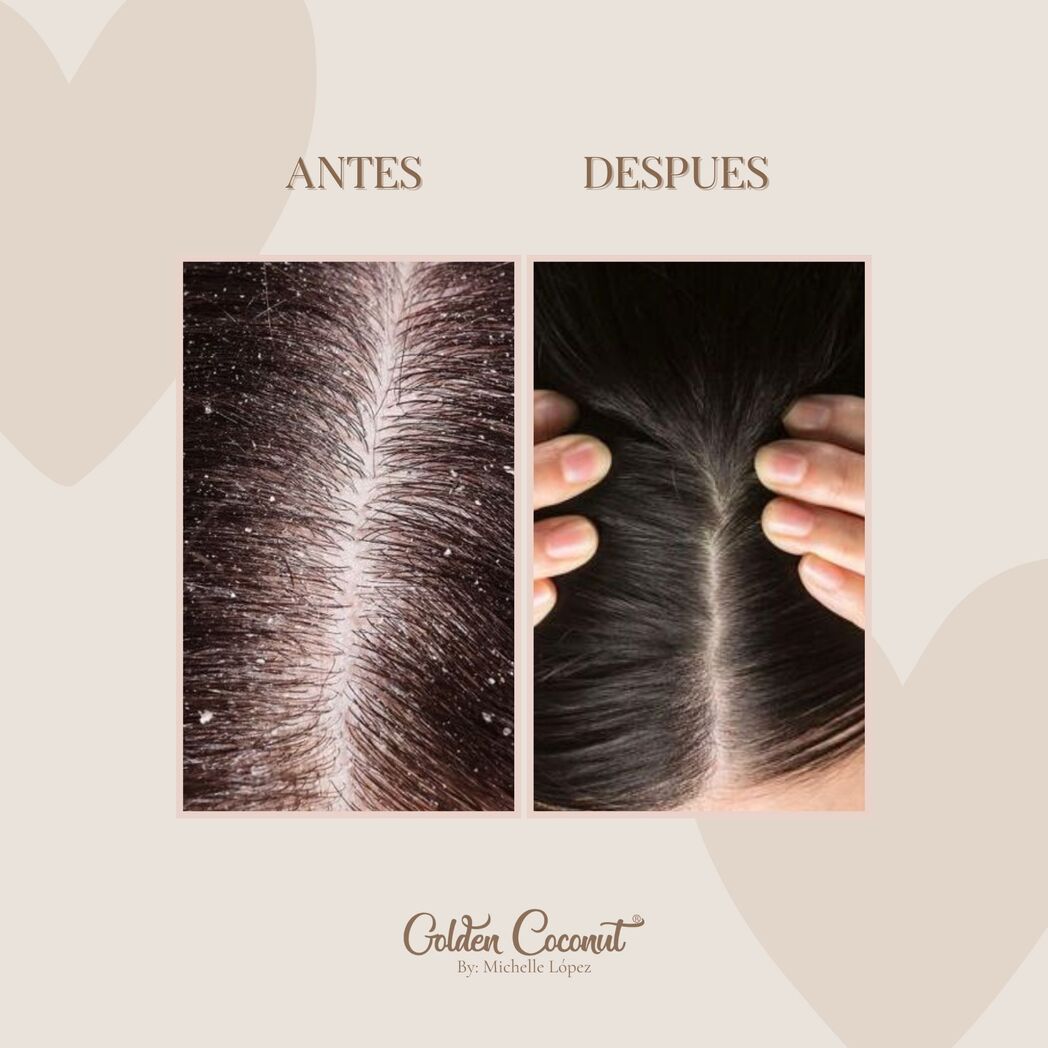 Golden Bloom – Scalp Scrub